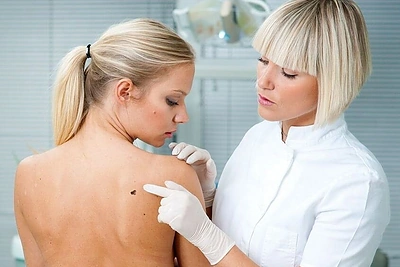 Apčiuopėte ant kūno gumbelį? Tai nebūtinai vėžys