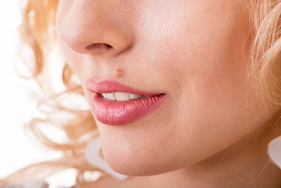 Ką reiškia apgamai ant jūsų kūno