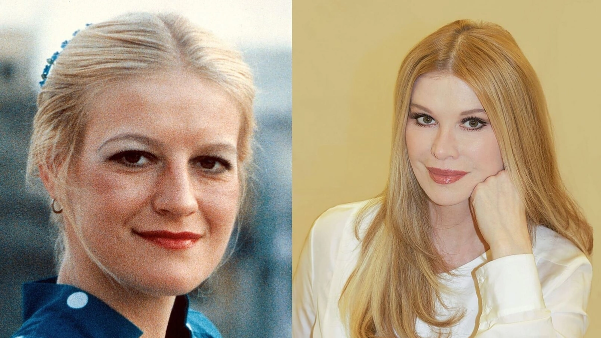 Cindy Jackson: išvaizda prieš operacijas ir po.
