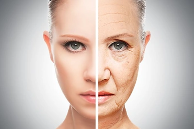 Gydymo metodai pagal raukšlių tipus. Pataria gydytojos dermatologės
