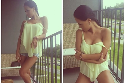 Indrė Burlinskaitė pakurstė kalbas apie padidintą krūtinę