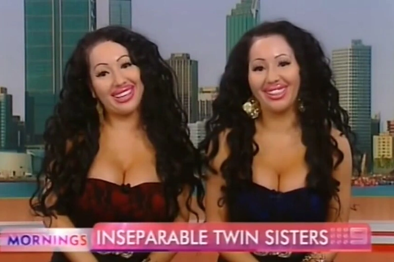 Dvynės Anna ir Lucy DeCinque