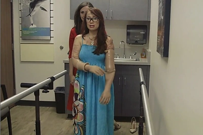 Niujorko mados savaitės podiumu žengė visų galūnių netekusi moteris