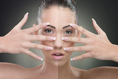 Dėmės ant veido: kada verta sunerimti?