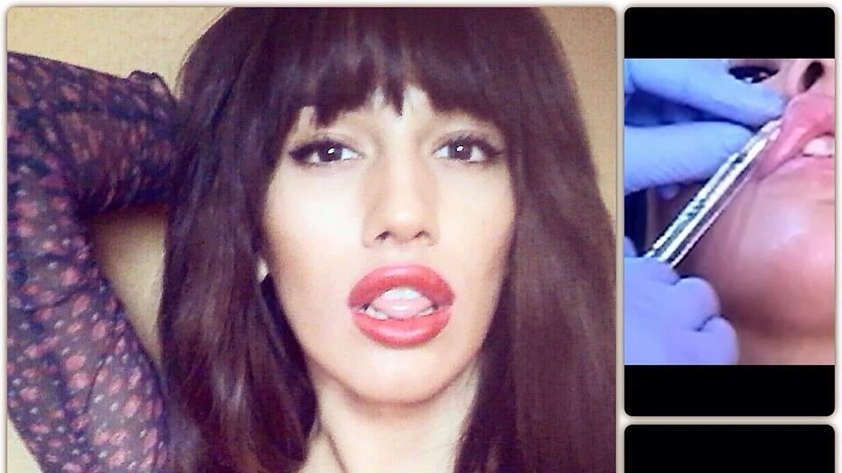 Raulis Mammadli-Agness