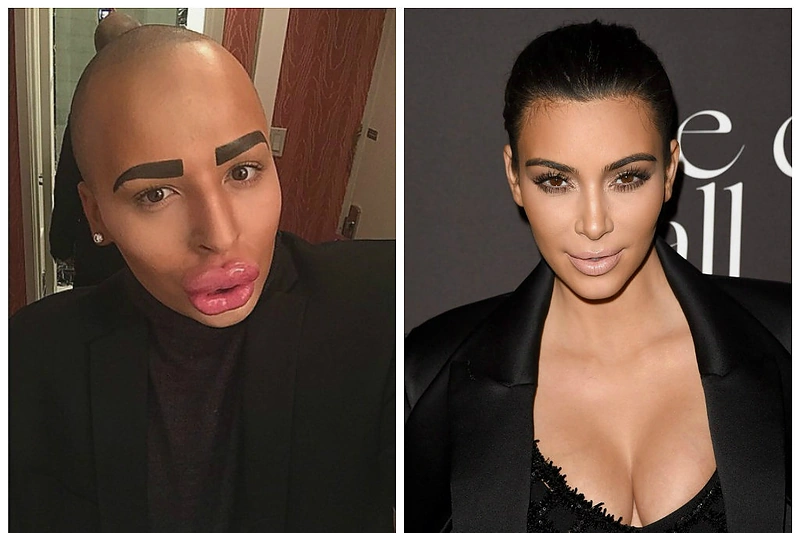 Dėl Kim Kardashian pamišęs jaunuolis išleido 150 tūkst. dolerių, kad būtų panašus į ją