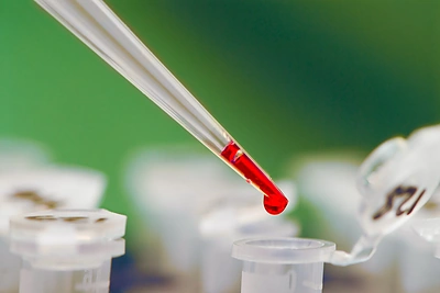 Ką rodo bendras kraujo tyrimas? Gydytojos komentaras