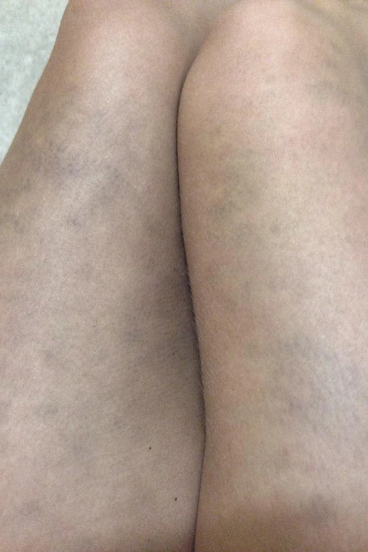 Jolantos Leonavičiūtės kojos