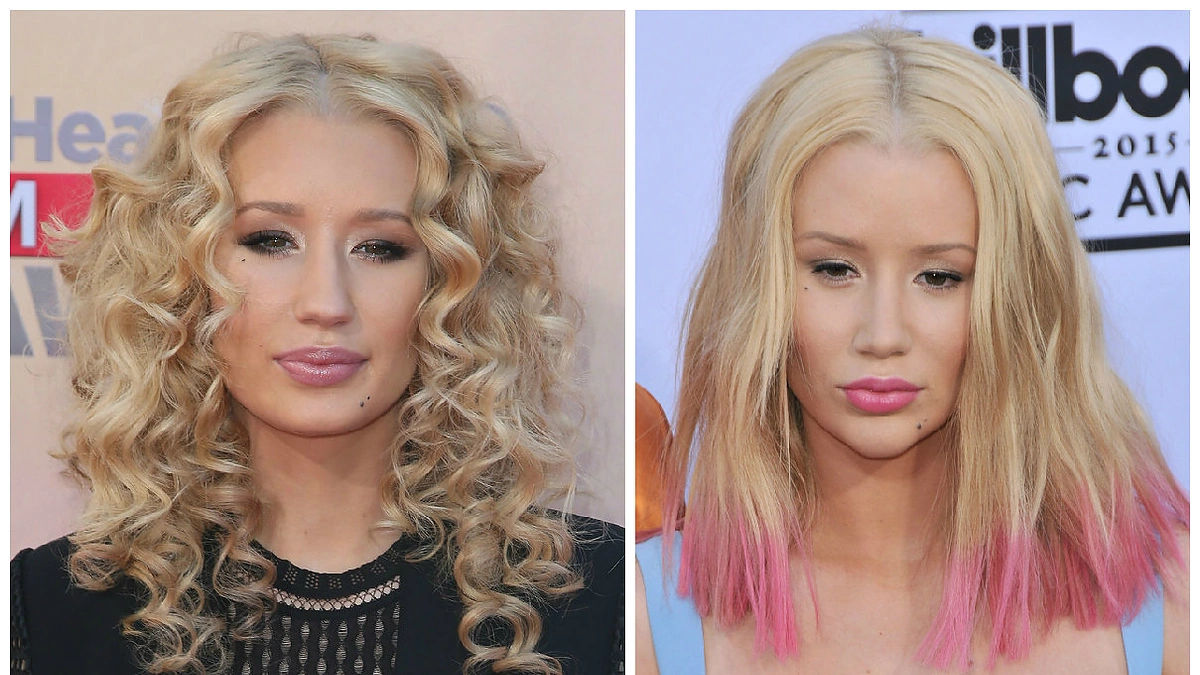 Iggy Azalea anksčiau ir dabar