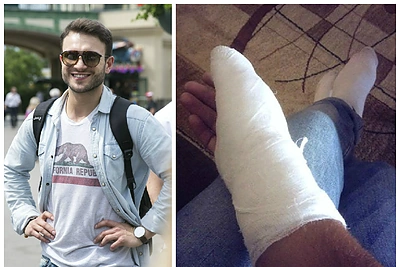 Vaidui Baumilai Kipre lūžęs pirštas koncertuoti netrukdo