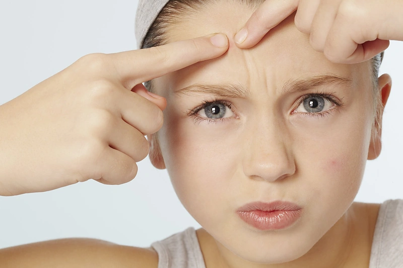 „Veido žemėlapis“: ką apie jūsų sveikatą sako bėrimai ir dėmės?