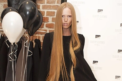 Rasos Ciūnės istorija – įkvėpimas tiems, kurie mano kad liga sudaužys svajones