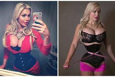 Švedė Pixee Fox dėl svajonės atrodyti kaip animacinio filmuko herojė išsioperavo šonkaulius