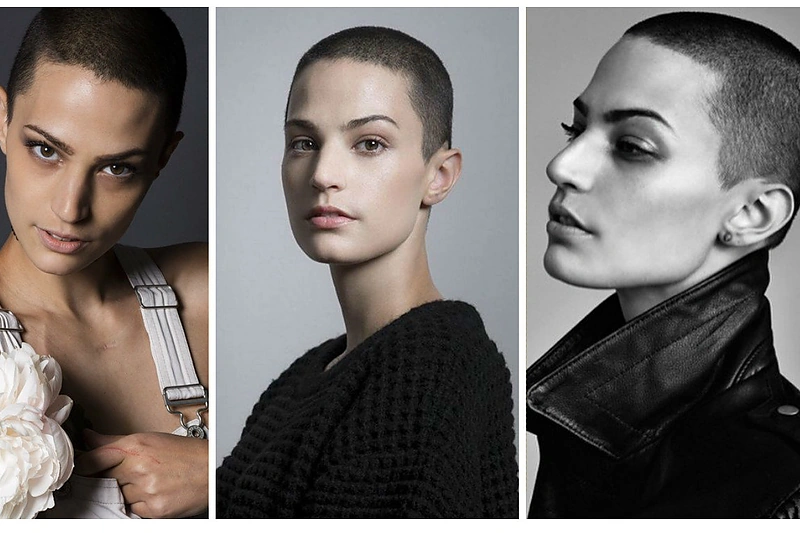 Su vėžiu kovojanti niujorkietė tapusi modeliu įkvepia nesislėpti ir nepasiduoti