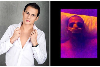 Atlikėjas Soliaris paviešino vaizdo įrašą iš klinikos po plastinės operacijos