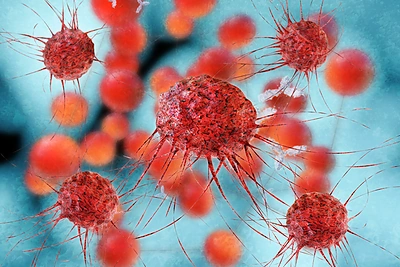 Lėtinis stresas skatina vėžio plitimą