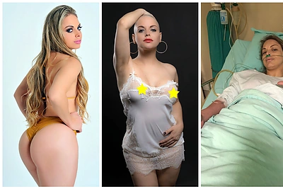 Brazilei Jessicai Lopes vėžys – ne priežastis atsisakyti plastinių operacijų: „Noriu mirti tobula“