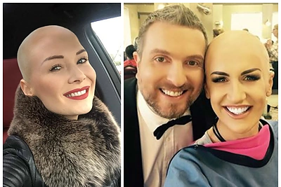 Natalija Bunkė pasekė Katažinos pavyzdžiu: „Gražiam žmogui viskas tinka“