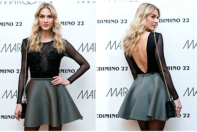 Perregimas Simonos Starkutės įvaizdis tapo jos vizitine kortele: „Galėčiau sau leisti ir dar daugiau“