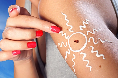 Kad saulė nepakenktų: 5 naujausi faktai apie odos vėžį