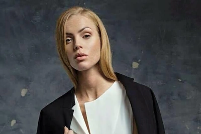 „The Model Convention Baltics“ dalyvė Rasa Ciūnė viliasi, kad jos istorija įkvėps ne vieną