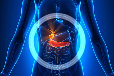 Pankreatito priežastys – ir imuninės, ir genetinės, ir idiopatinės