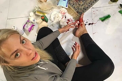 Bandydama atlikti triuką su stiklais Liepa Norkevičienė susipjaustė koją: „Repeticijos baigtos“