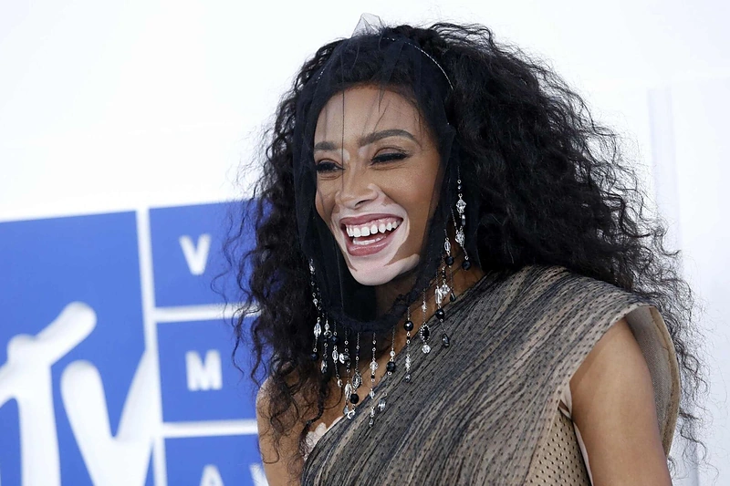 Skirtingi grožio pavidalai: nestandartinių modelių šlovės metai