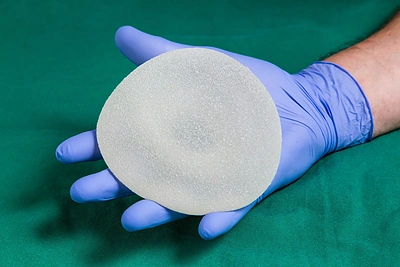 Chirurgas S.Vikšraitis: tobulų ir amžinų krūtų implantų nėra