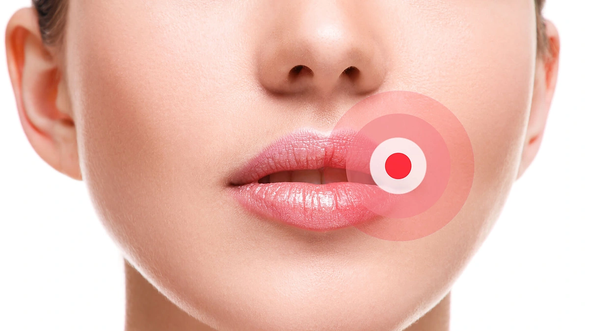 Lūpos.