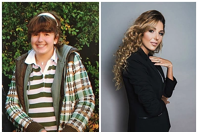 84 kg svėrusi ir anoreksiją išsigydžiusi Sofio Gelašvili: „Pradėjo kristi plaukai, klibėti dantys“