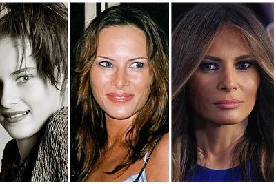 Melania Trump anksčiau ir dabar: neigia tobulinusi veidą, tačiau nuotraukos sako ką kita