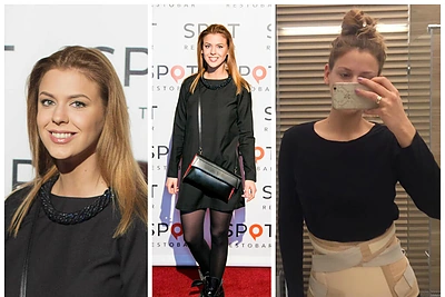 Dileta Meškaitė po stuburo slankstelio lūžio į vakarėlį atvyko su įtvaru: „Pirkau platesnę suknelę“