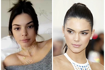 Papilnėjusios Kendall Jenner lūpos gerbėjams sukėlė įtarimų: modelis jas pasididino?