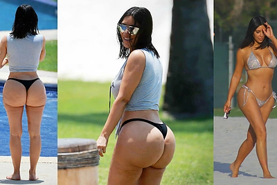 Susirūpinimą dėl Kim Kardashian sėdynės išreiškė ir specialistai: padėtis tampa nebekontroliuojama