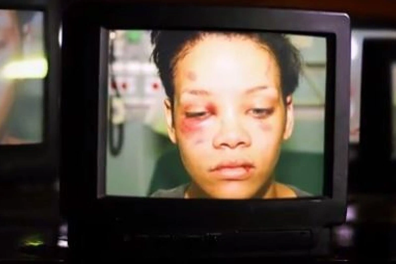 Rihanna po užpuolimo