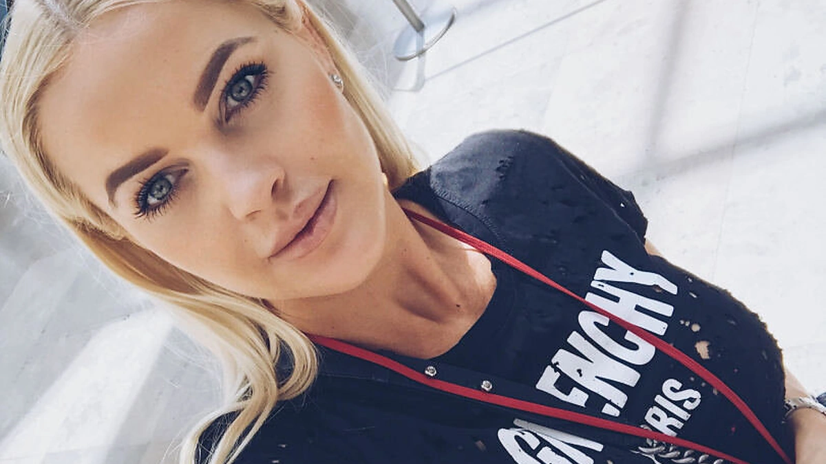 Neringa Šiaudikytė apsilankė pas Kim Kardashian plastikos chirurgą