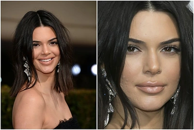 Bandžiusiems ją sugėdyti dėl odos – Kendall Jenner atkirtis