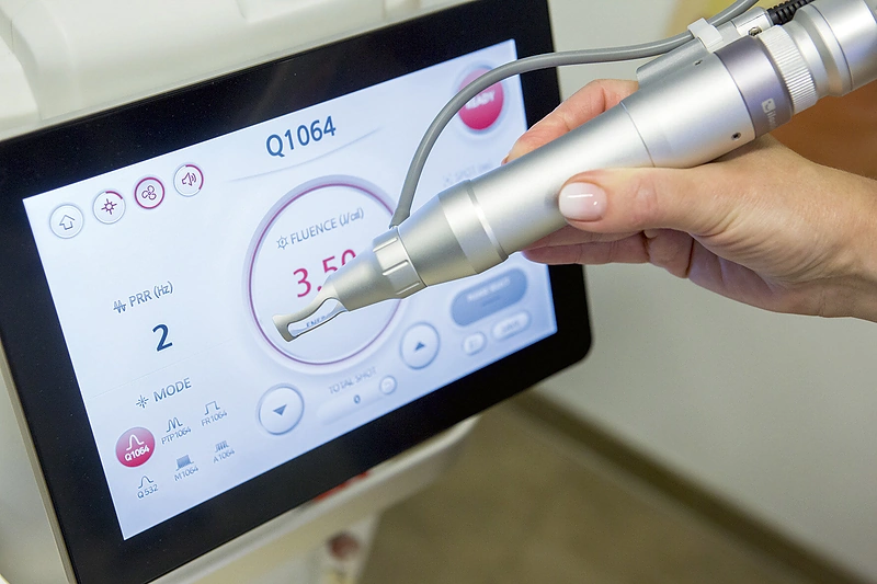 „Q-Switched Nd:YAG“ lazeris/Organizatorių nuotr.