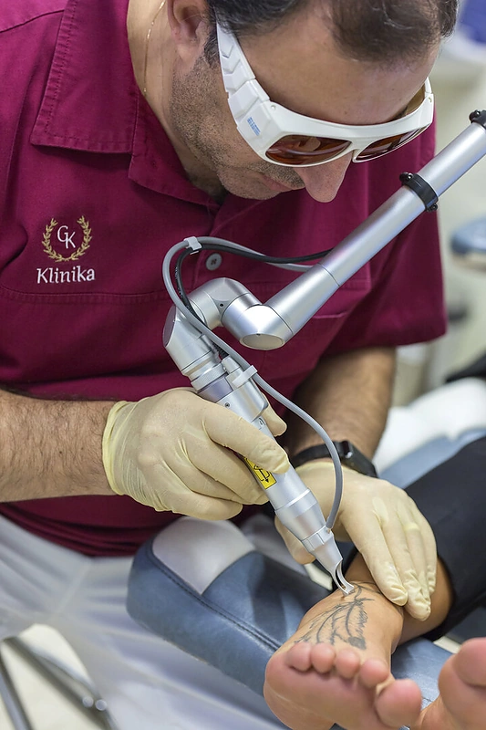 „Q-Switched Nd:YAG“ lazeris/Organizatorių nuotr.