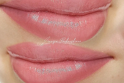 ILGALAIKIO GROŽIO KLINIKA