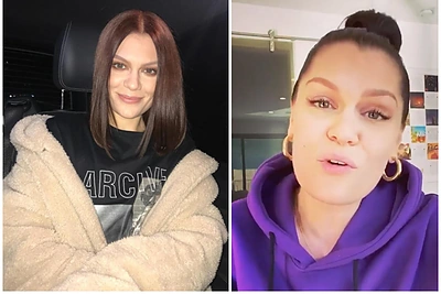 Jessie J per Kūčias atsidūrė ligoninėje: „Laimė, kad laiku kreipiausi į medikus“