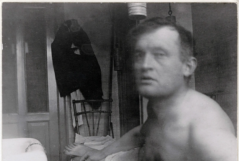 Munchas sakydavo, kad fotografija neprilygsta tapybai, bet su malonumu darydavo asmenukes. Šioje (vieta – Dr. Jacobsono klinika) jis save įamžino kaip moters nužudytą Prancūzijos revoliucijos herojų Maratą. 1908–1909. Muncho muziejus, Oslas / Vida Press nuotrauka