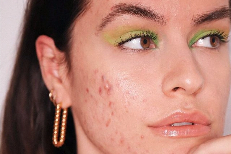 Veidas su problemine oda