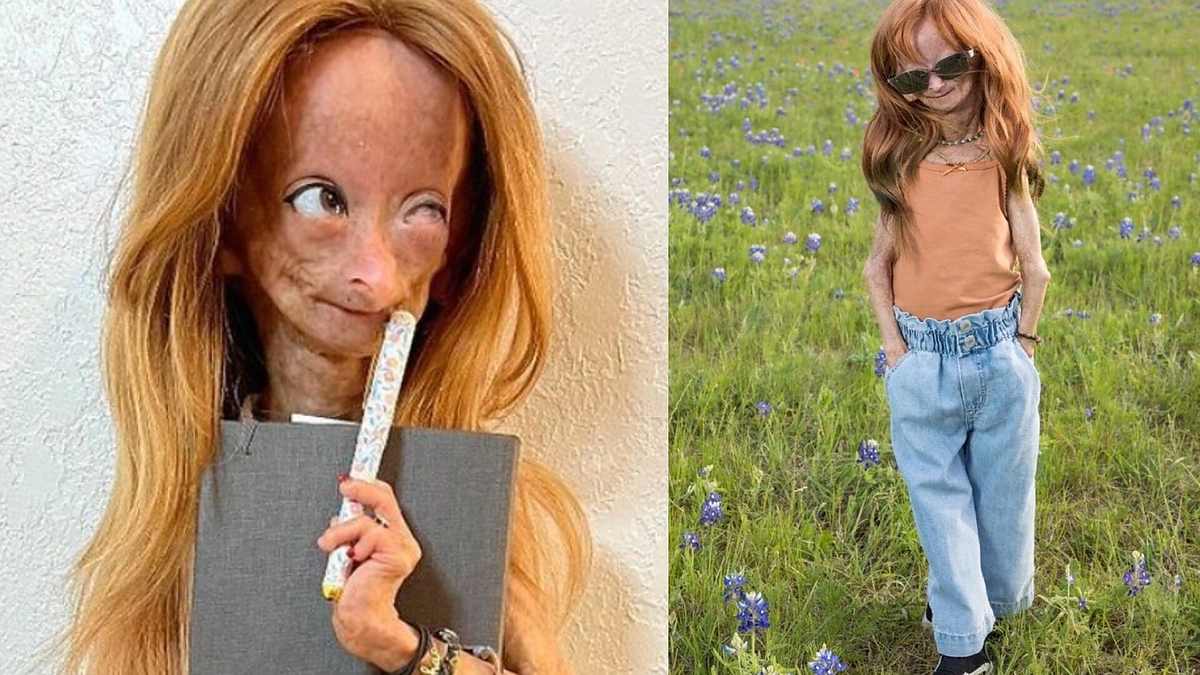 Adalia Rose / „Instagram“ nuotr.