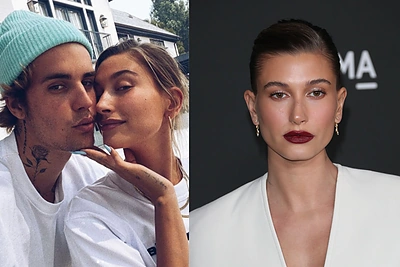 Justino Bieberio žmona Hailey Bieber dėl krešulio smegenyse buvo paguldyta į ligoninę