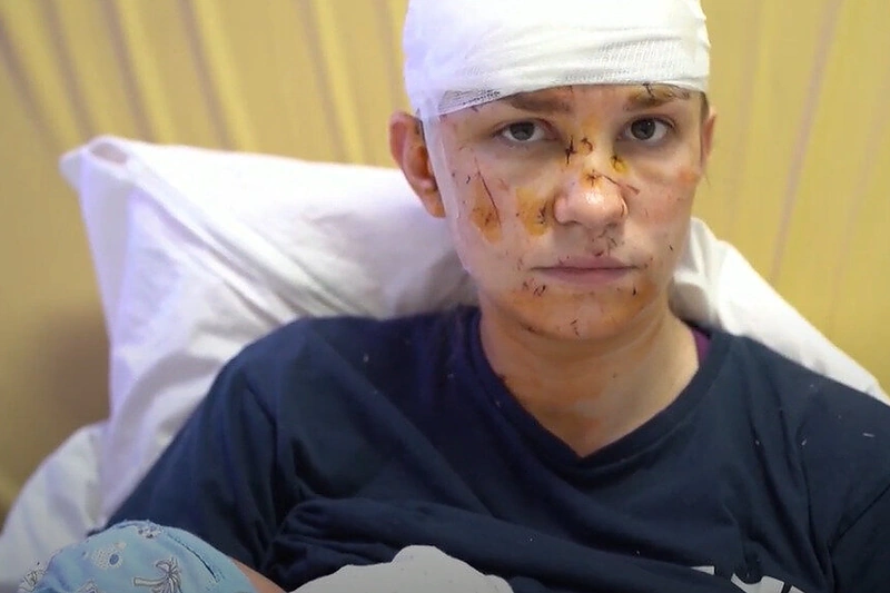 Ukrainietė Olga, savo kūdikį apsaugojusi per apšaudymą / Stopkadro nuotr.