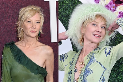 Aiškėja daugiau detalių apie aktorės Anne Heche sveikatos būklę: šeima ir draugai prašo melstis