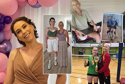 Dėl vėžio kojos netekusi abiturientė Veronika Čepanskytė stebina drąsa ir nevaikiška valia