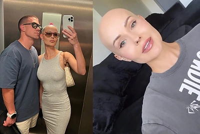 I.Burlinskaitė prabilo apie krūtų implantų galimą žalą: „Jei nesirgčiau, operaciją atliktume nedelsiant“